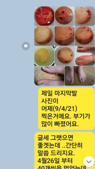 텔로유스,한국텔로유스,텔로유스 남가주, 텔로유스 엘에이, 텔로유스 한국,텔로유스 OC, 텔로유스 면역력강화,텔로유스 젊음회복,텔로유스 만성피로회복,텔로유스 시력회복,텔로유스 청력회복,텔로유스 분노조절,텔로유스 깊은숙면,텔로유스 피부탄력회복 8